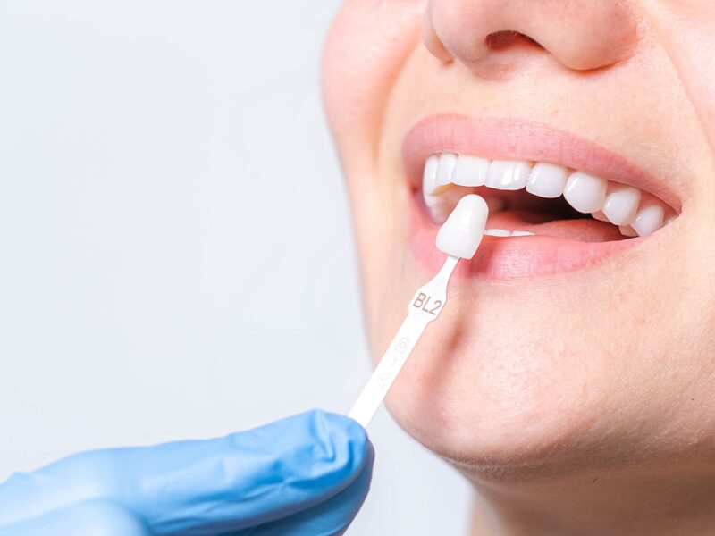 Estetica Dental Imagen
