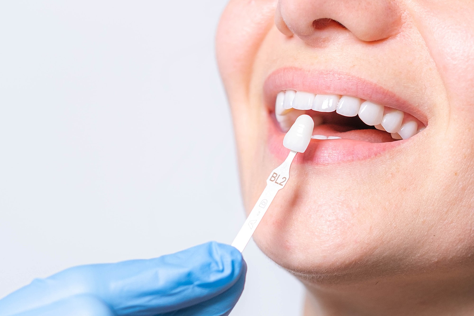 Estetica Dental Imagen